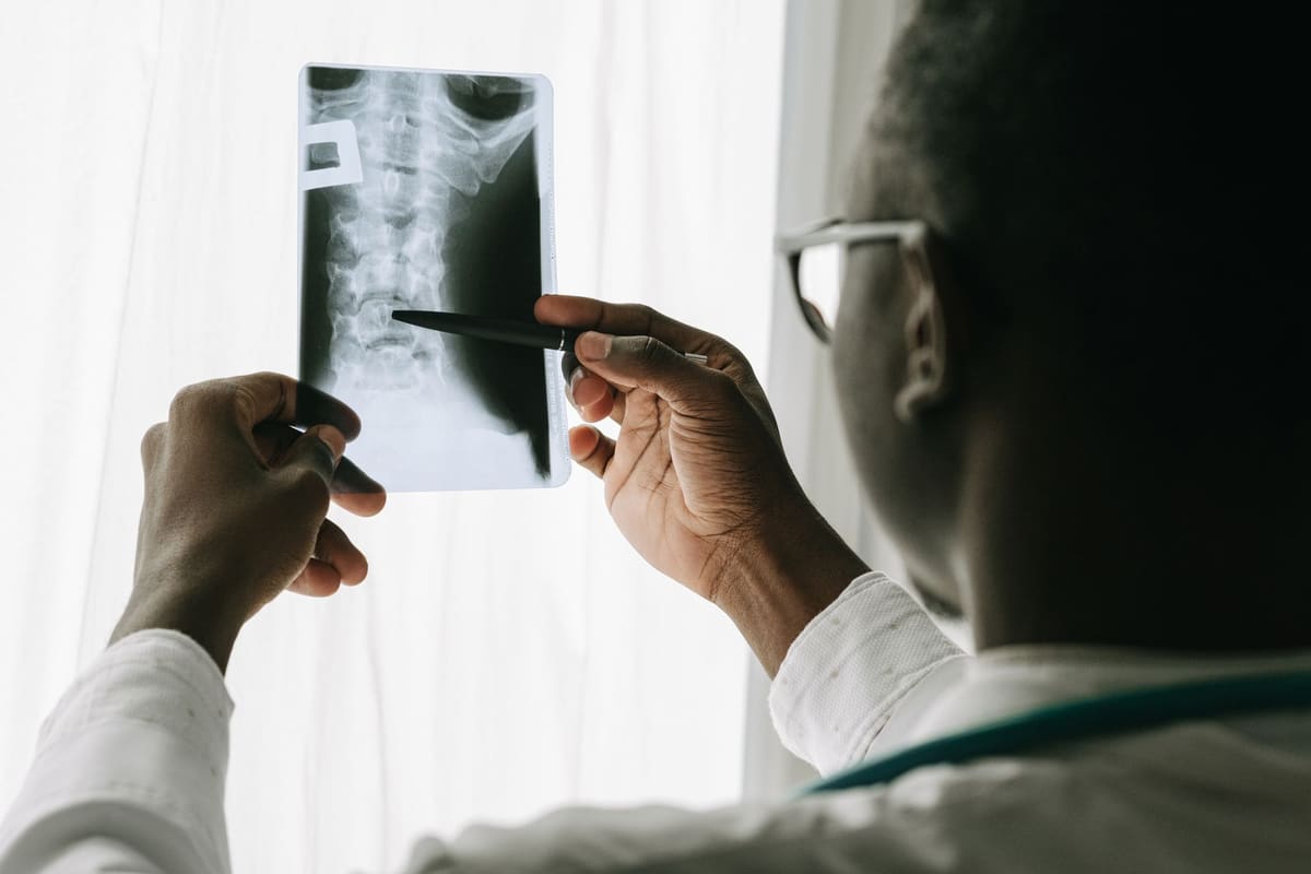 A physician in a white coat holds a cervical spine X-ray up to the light and points to a vertebra with a pen.