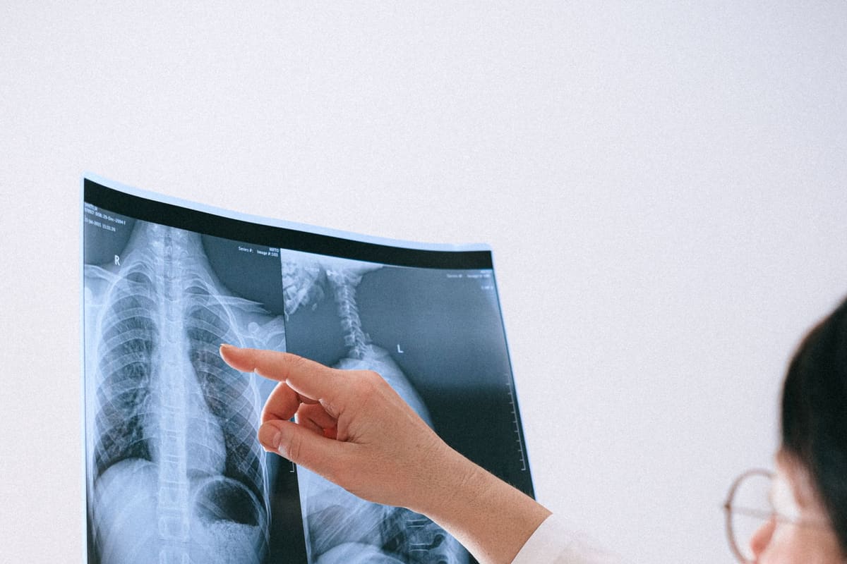 A physician points to vertebrae on a spinal X-ray while evaluating a patient for an interventional pain procedure.